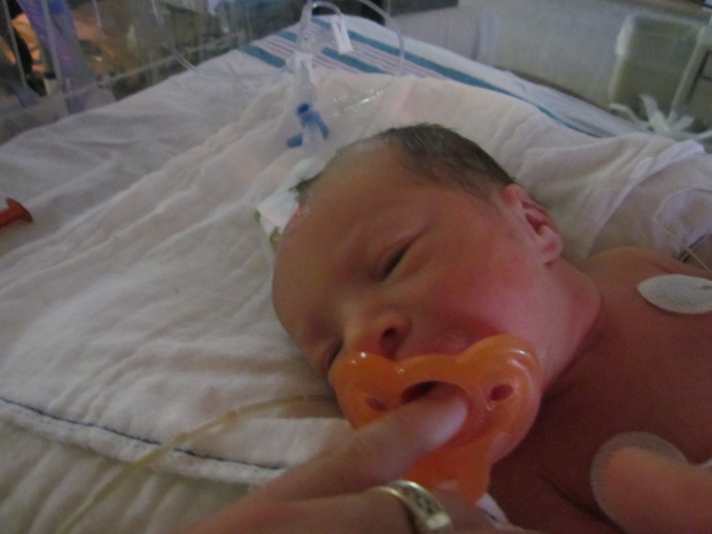 NICU