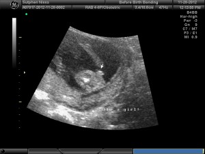 It's a girl!