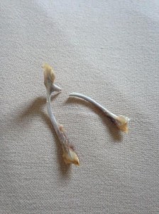 Wishbone