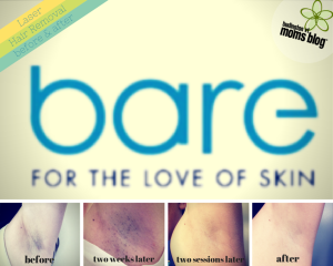 BareBefore & After