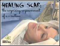 Healing Scar: the surprising empowerment of a c-section