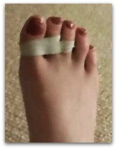 Injuries, bruised toes