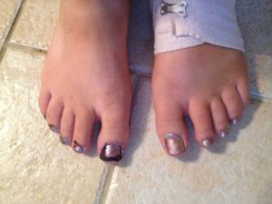 poorly painted toenails.