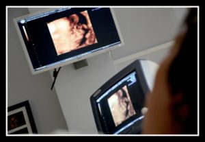 woman watching ultrasound of ectopic pregnancy