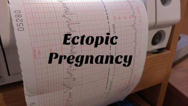 Ectopic Pregnancy – When Pregnancy Goes Wrong medical chart for ectopic pregnancy