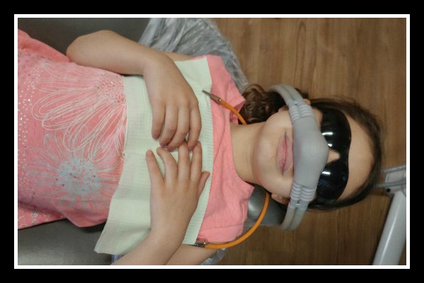 child at dentist wearing mask for nitrous oxide, laughing gas