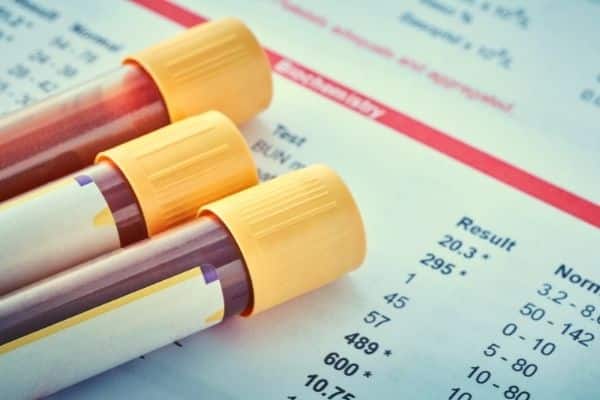 test tubes filled with something that looks like blood, with unidentified test results printed behind
