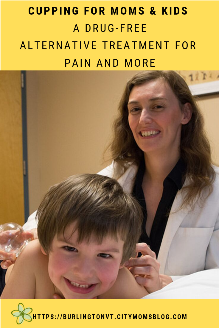 Cupping For Moms and Kids: A Natural Alternative Treatment and Traditional Folk Remedy