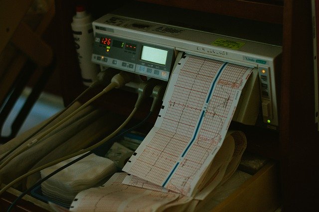 Contraction monitor in a hospital