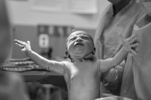 cesarean
