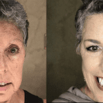 Nan before and after featured image