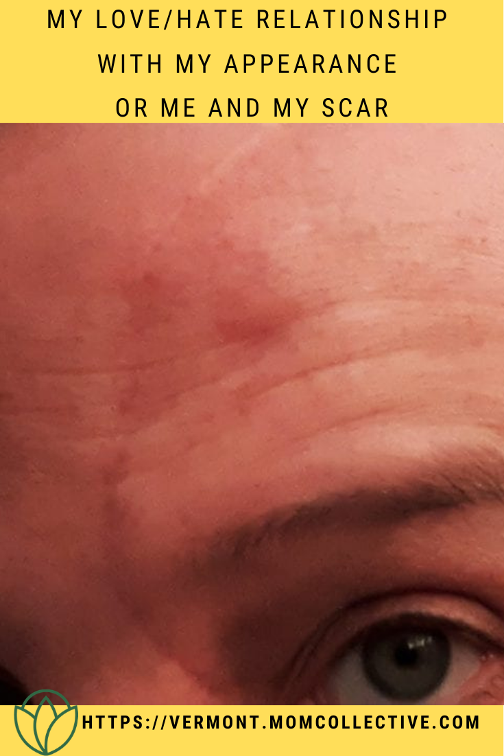 My Love/Hate Relationship with My Appearance or Me and My Scar