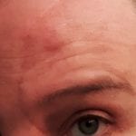 my scar