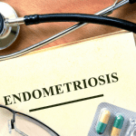 endo 4