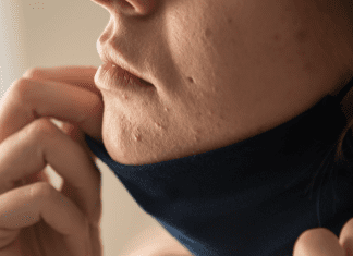 Treating my "maskne" and other skincare tips for moms