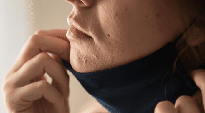 Treating My “Maskne” and other Skincare Tips for Busy Moms Treating my "maskne" and other skincare tips for moms