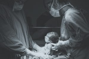 cesarean section