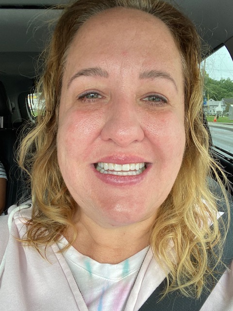 woman smiling with straight teeth