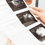 Image from uterine ultrasound