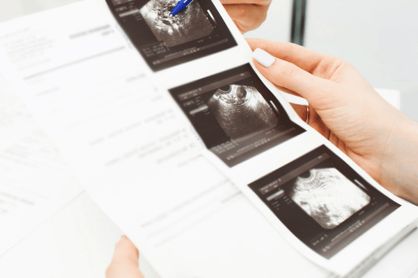 uterine ultrasound image