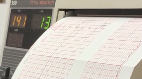 A digital read-out on white and red graph paper from a fetal monitor
