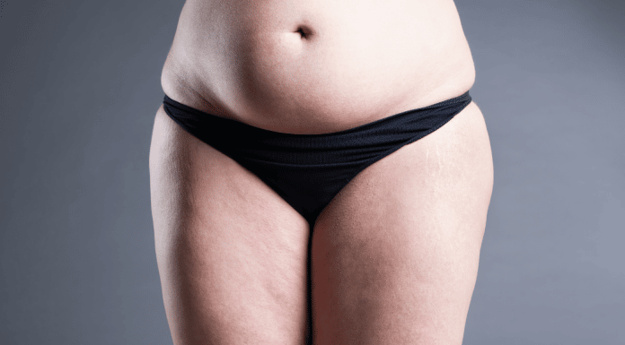 I Am Ashamed of My Stomach: A Mom Reflects I Am Ashamed of My Stomach: A Mom Reflects